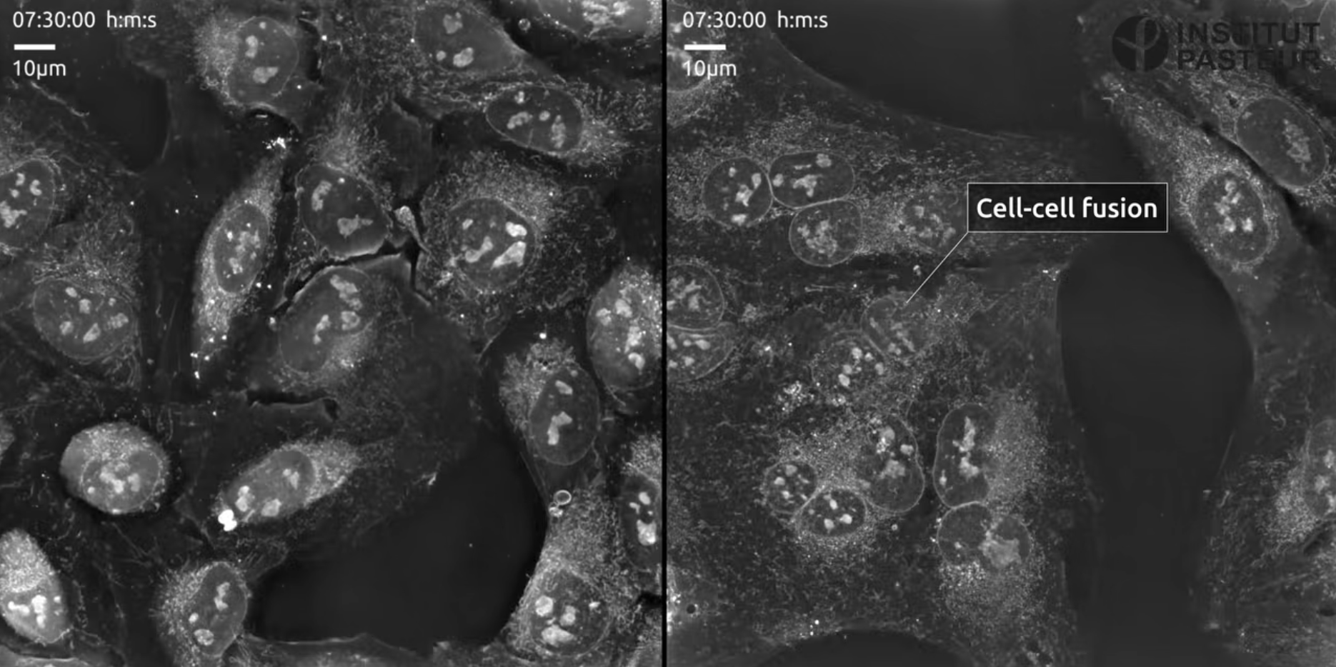 Ako oslabíme Sars Cov 2, ak ho aj úplne nezabijeme? Odpoveď je: Extrahujme lišajník a jeho molekuly.